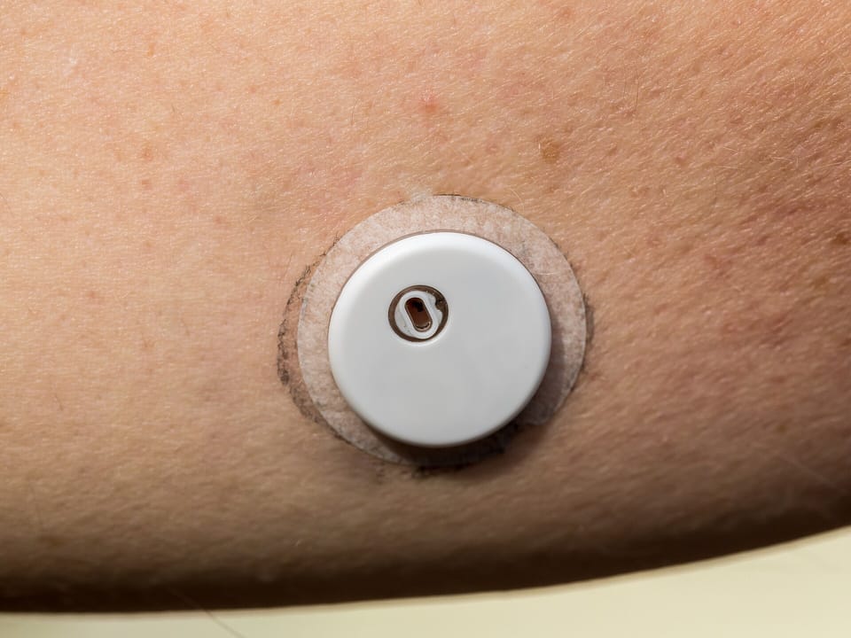 A small round continuous glucose monitor sensor attached to the skin of an upper arm